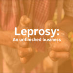 Leprosy:  An unfinished business